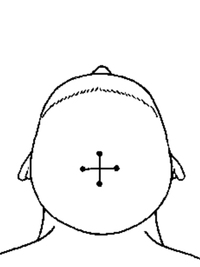 四神聪