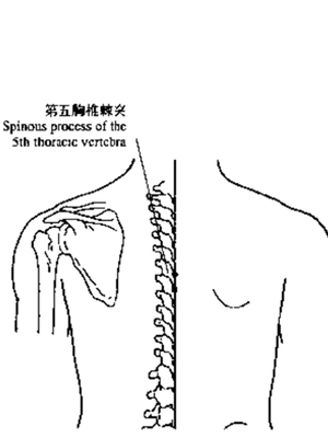 背穴