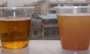 膏淋