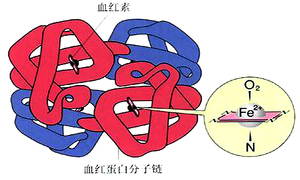 一氧化碳中毒