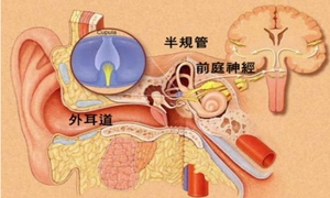 耳眩晕