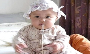 小儿呕吐