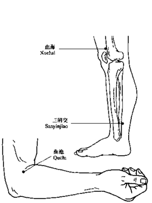 肤痒