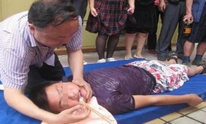 癫病