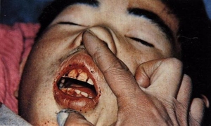 伏暑