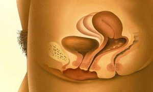 尿道瘘