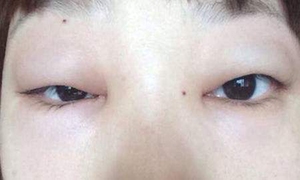正水