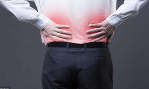 急性腰痛