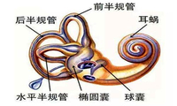 良性阵发性位置性眩晕