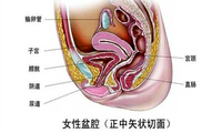 盆腔炎性疾病