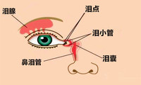 泪腺脱垂