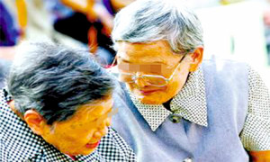 路易体痴呆