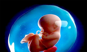 尿道缺如及先天性尿道闭锁