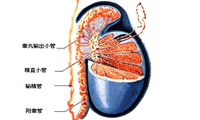 输精管缺如