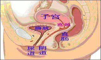 阴道异物