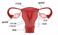 阴道纵隔