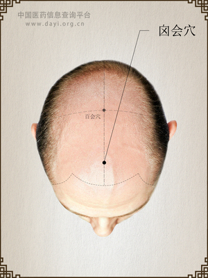 囟会穴